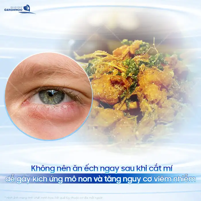 Sau cắt mí có được ăn ếch không? Có gây ảnh hưởng đến vết thương không?