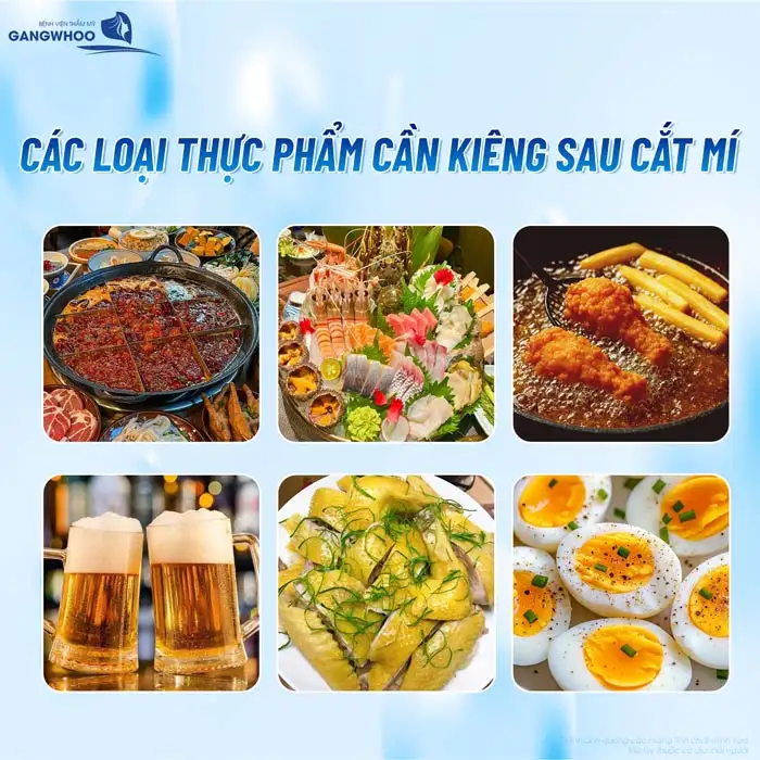 Cắt mí có được ăn ốc không? Cần kiêng ăn ốc trong bao lâu?