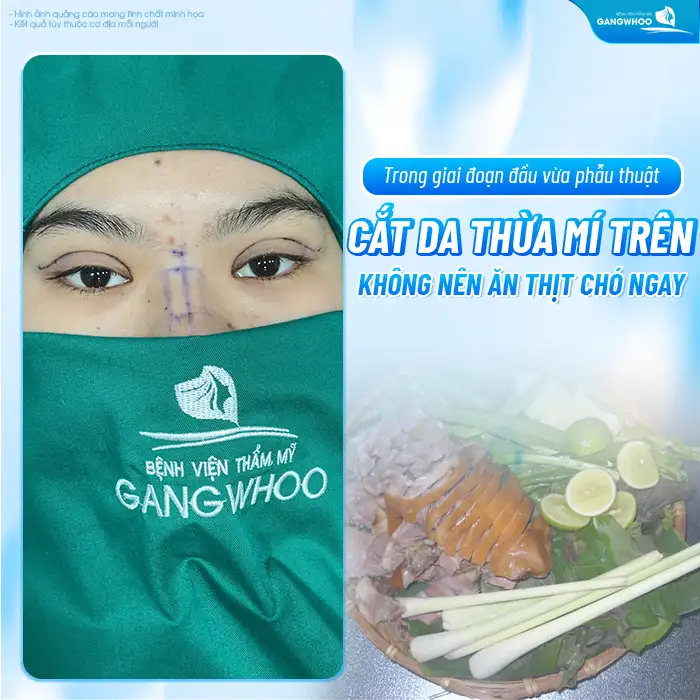 Cắt mí có ăn được thịt chó không? Nên kiêng ăn thịt chó bao lâu?