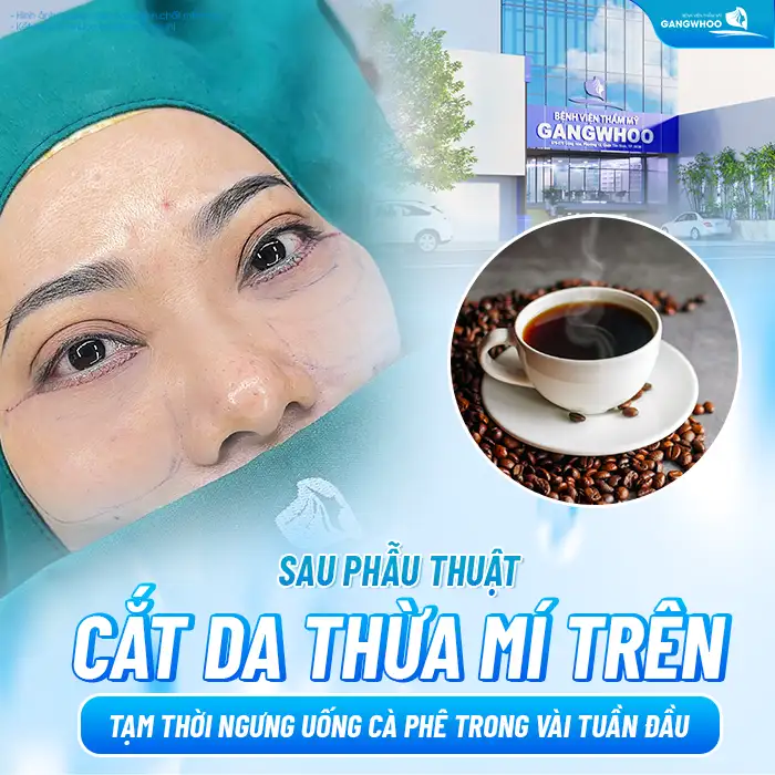 Cắt mí có được uống cà phê không? Nên kiêng uống cà phê bao lâu