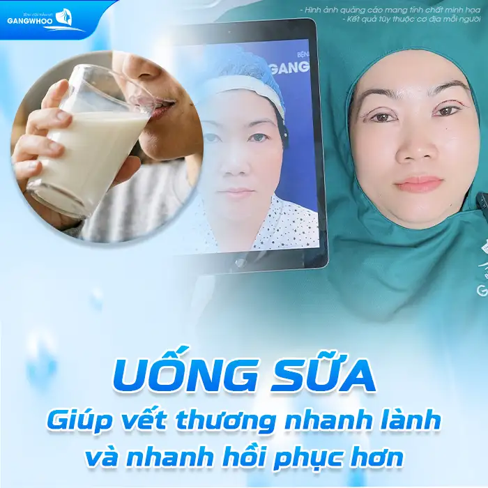 Cắt mí có được uống sữa không? Lợi ích khi uống sữa sau cắt mí