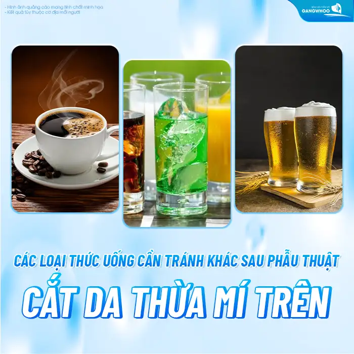 Cắt mí có được uống trà sữa không? Bao lâu thì được uống trà sữa