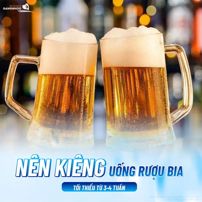 Cắt mí có được uống bia không? Sau cắt mí kiêng rượu bia bao lâu?