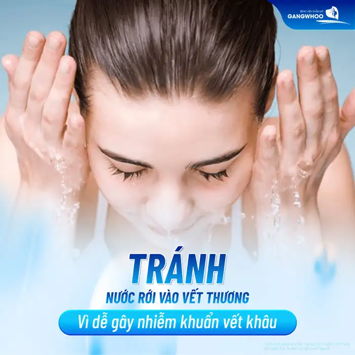 Cắt mí kiêng nước bao lâu? Vì sao cần phải kiêng nước sau cắt mí?