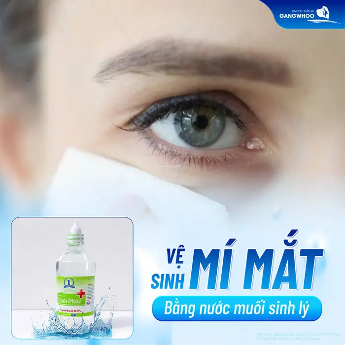 Cắt mí kiêng nước bao lâu? Vì sao cần phải kiêng nước sau cắt mí?