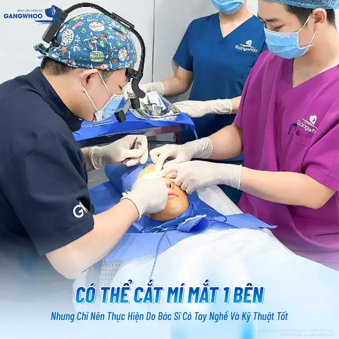 Cắt mí mắt 1 bên có được không? Nên lựa chọn phương pháp nào?