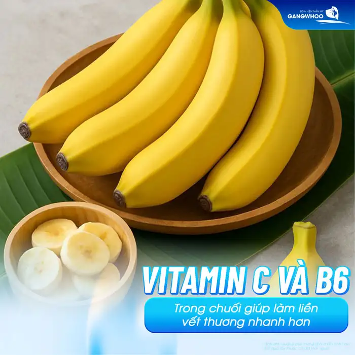 Sau phẫu thuật cắt mí mắt có được ăn chuối không?