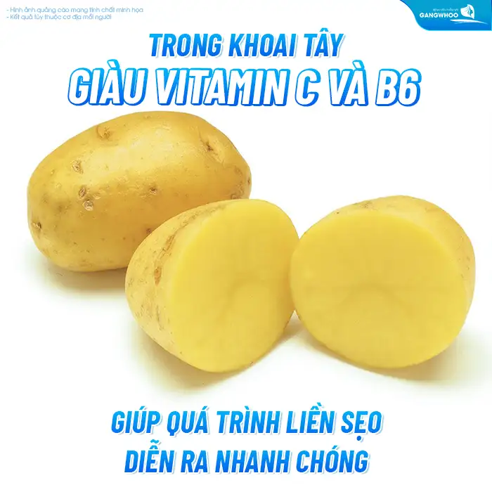 Sau cắt mí có ăn được khoai tây không? Những lưu ý khi ăn khoai tây