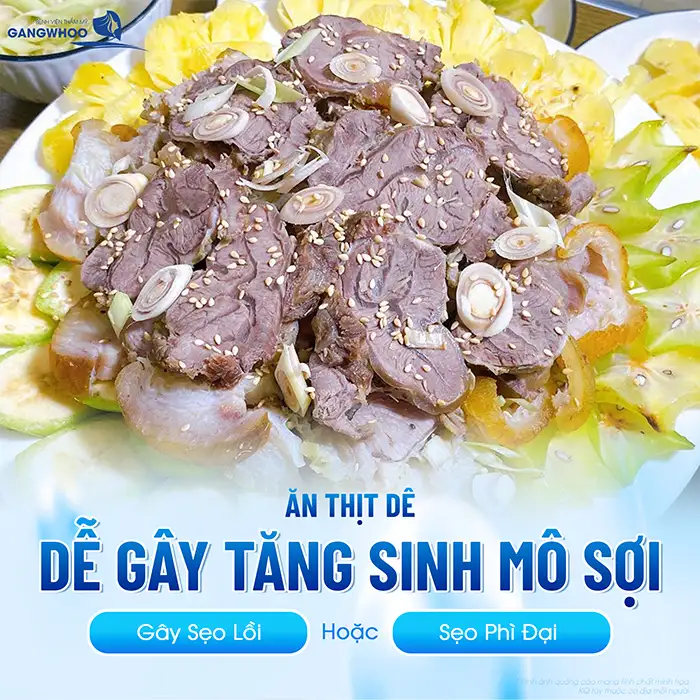 Cắt mí mắt ăn thịt dê được không? Nên kiêng thịt dê bao lâu?