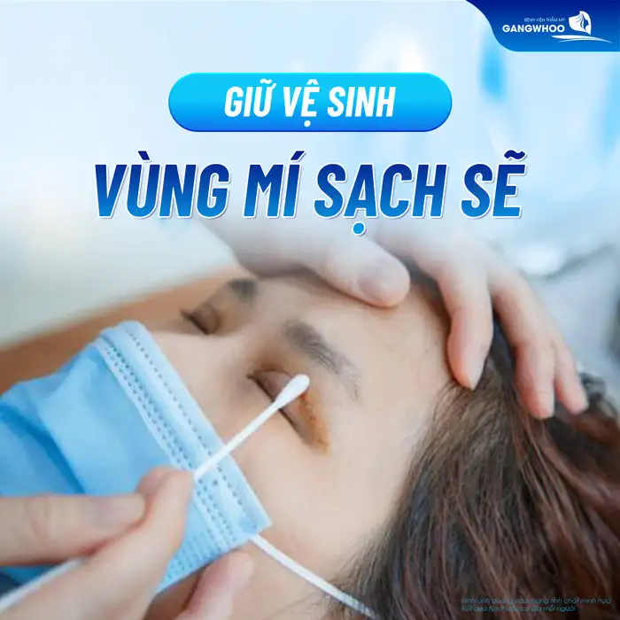Cắt mí mắt bao lâu thì cắt chỉ? Quy trình cắt chỉ ra sao?