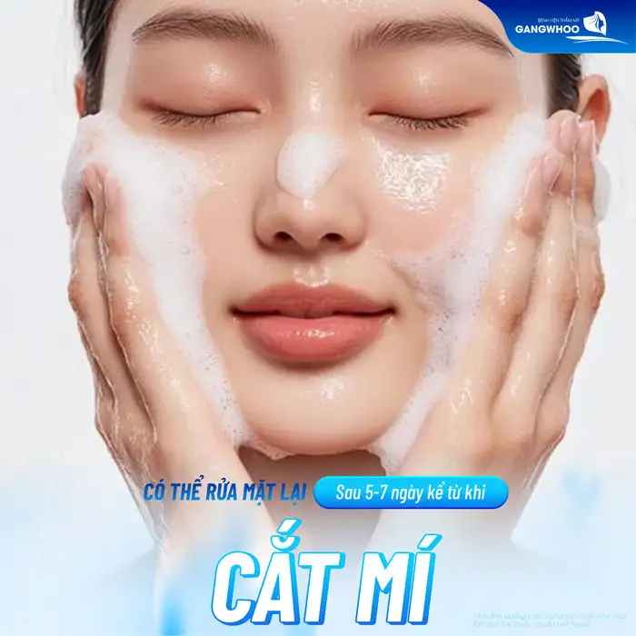 Cắt mí bao lâu thì được rửa mặt? Cách rửa mặt đúng cách sau cắt mí?
