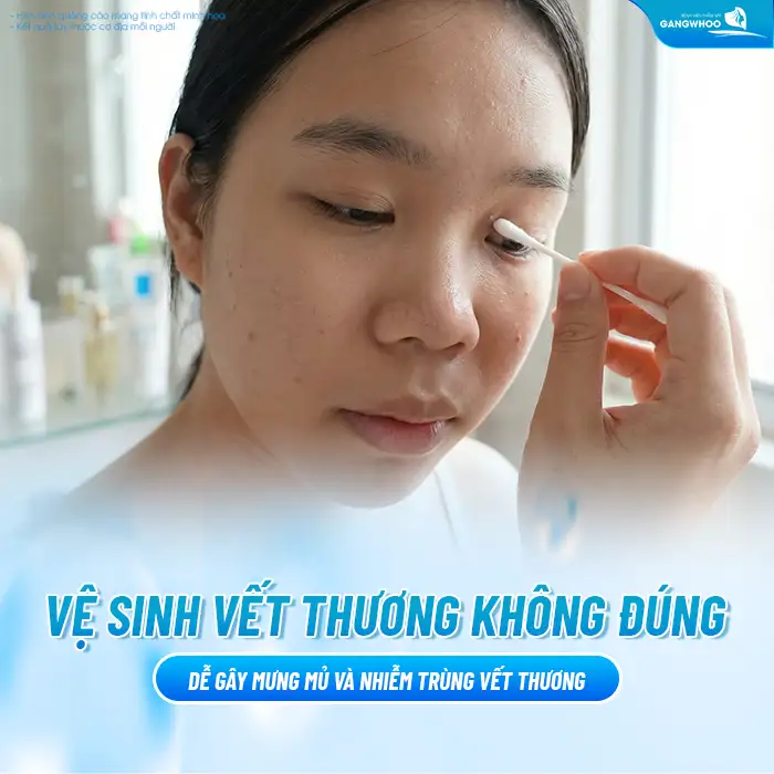 Nguyên nhân cắt mí bị mưng mủ là gì? Cách xử lý ra sao?