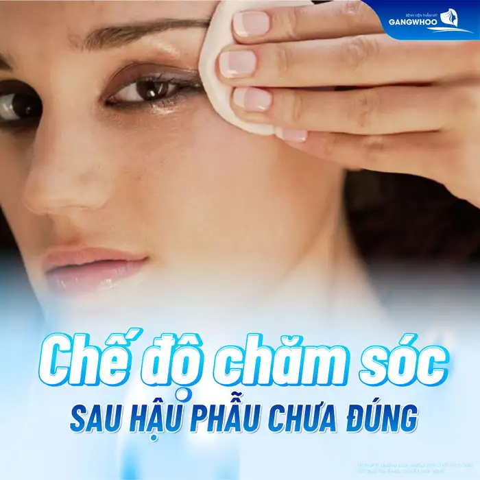 Cắt mí mắt bị thâm nguyên nhân do đâu? Cách xử lý ra sao?