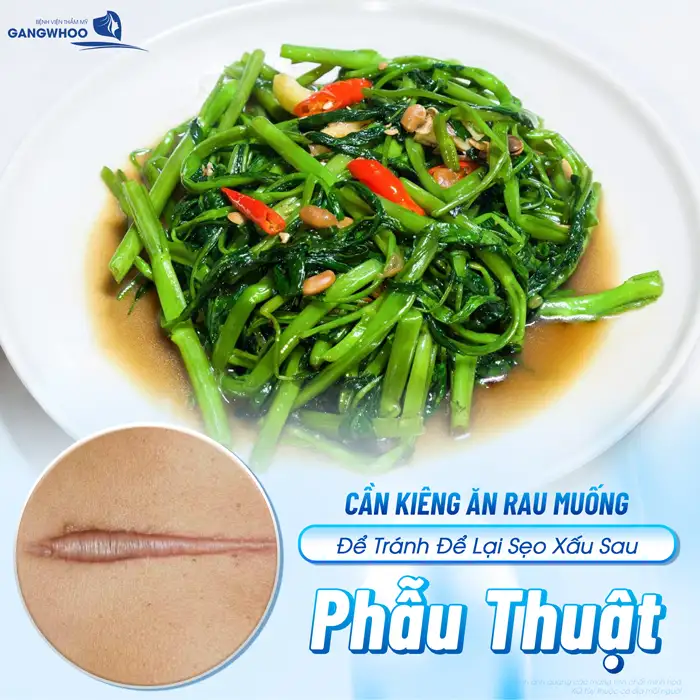 Sau cắt mí mắt cần kiêng rau muống bao lâu? Vì sao cần phải kiêng