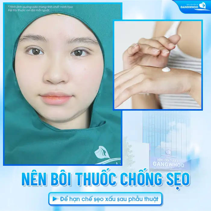 Cắt mí mắt có cần bôi thuốc chống sẹo không? Bao lâu thì được bôi?
