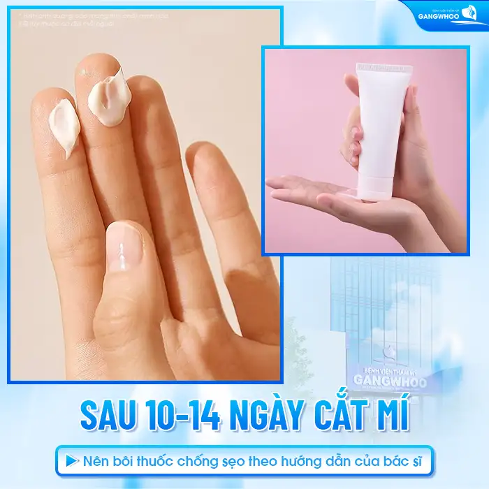 Cắt mí mắt có cần bôi thuốc chống sẹo không? Bao lâu thì được bôi?