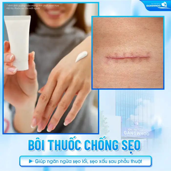 Cắt mí mắt có cần bôi thuốc chống sẹo không? Bao lâu thì được bôi?