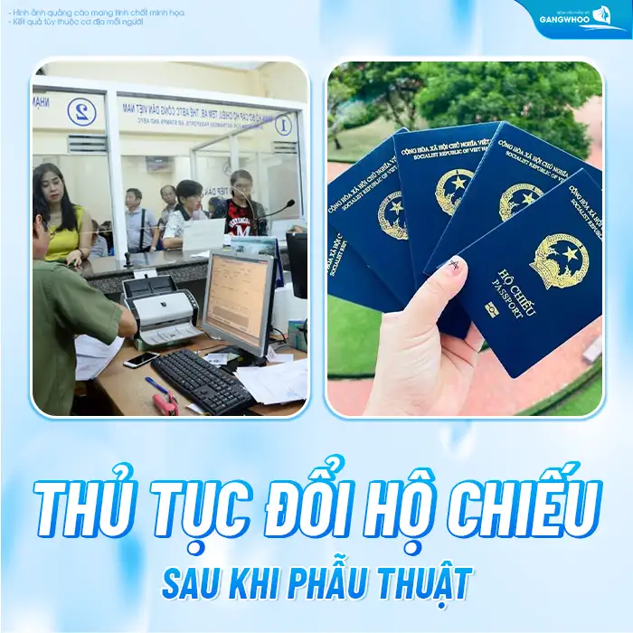 Sau cắt mí có phải làm lại hộ chiếu không? Khi nào cần làm lại?