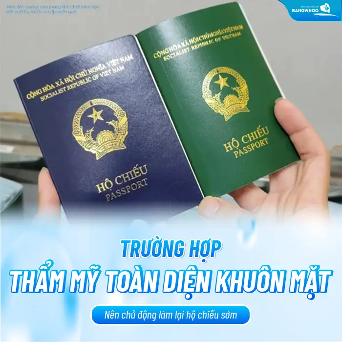 Sau cắt mí có phải làm lại hộ chiếu không? Khi nào cần làm lại?