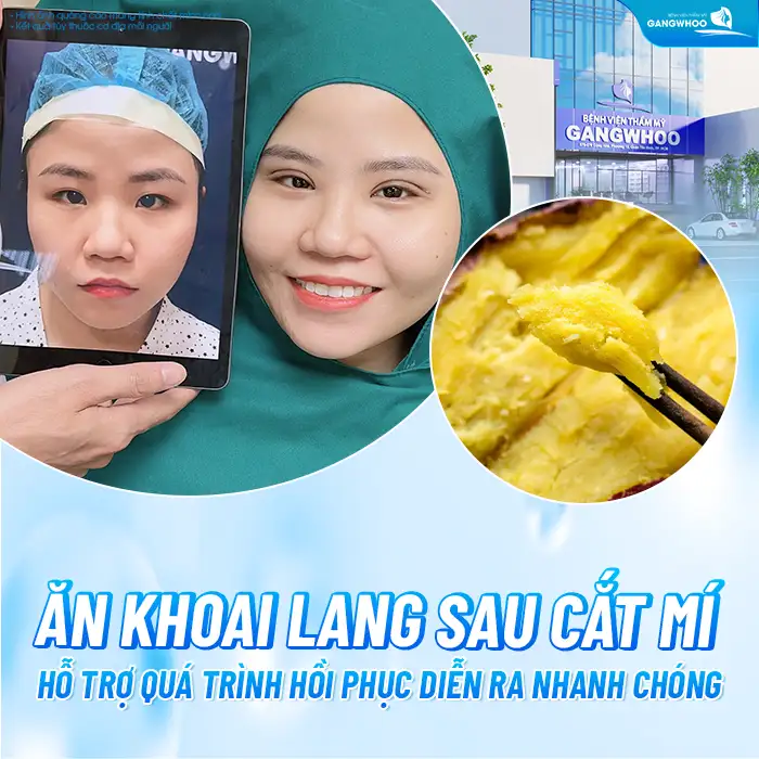 Cắt mí mắt có được ăn khoai lang không? Những lưu ý khi ăn khoai lang