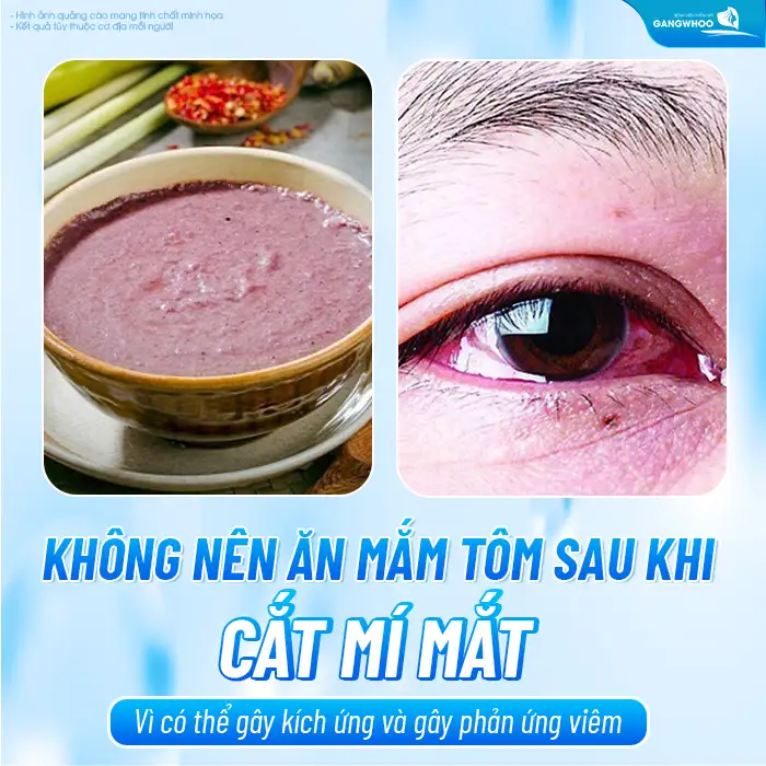 Cắt mí mắt có được ăn mắm tôm không? Bao lâu thì được ăn mắm tôm