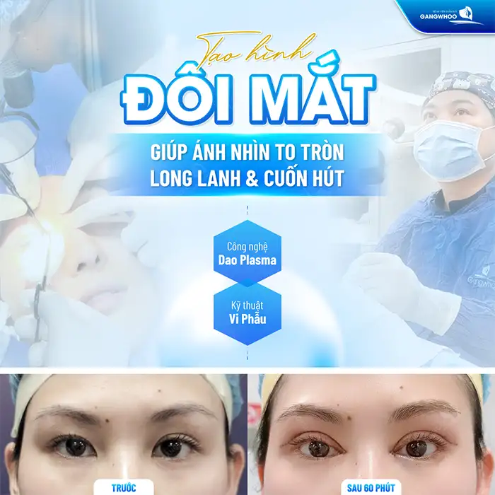 Cắt mí mắt cười là gì? Những ai phù hợp để cắt mí mắt cười