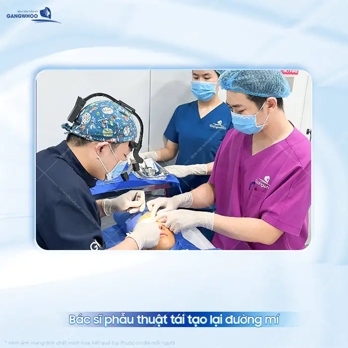 Cắt mí mắt quá dài nguyên nhân do đâu? Cách khắc phục ra sao?