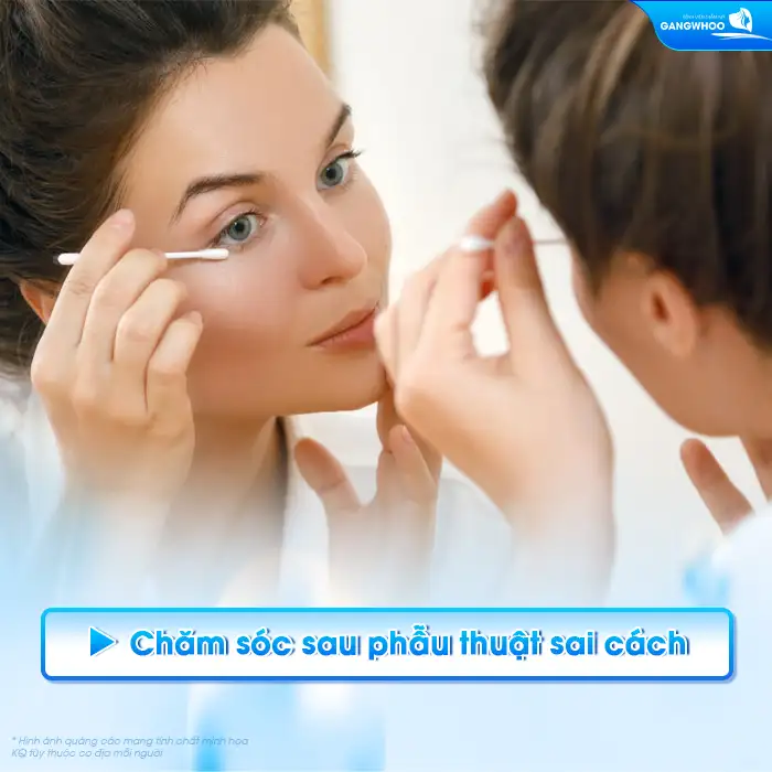 Vì sao cắt mí mắt sưng không đều? Cách xử lý ra sao?