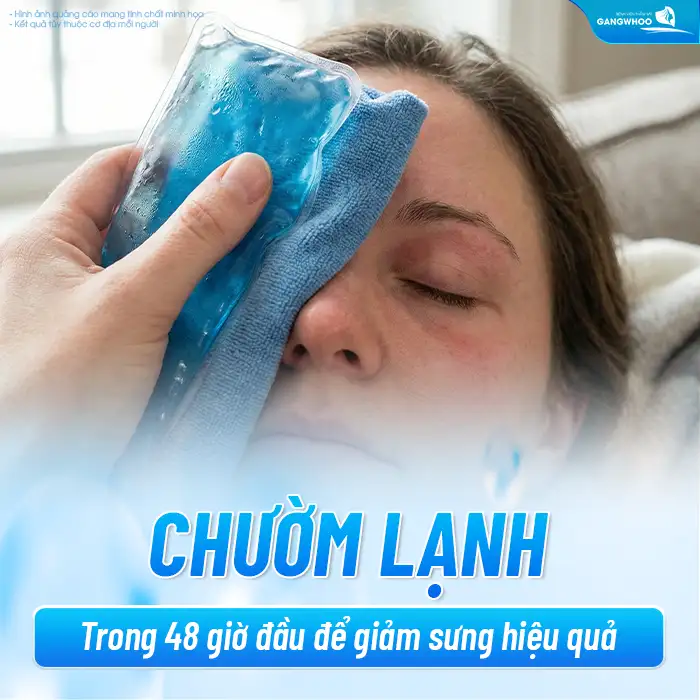 Cắt mí mini deep bao lâu thì hết sưng? Thời gian hồi phục bao lâu
