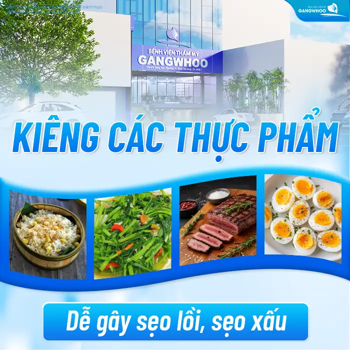 Cắt mí mini deep bao lâu thì hết sưng? Thời gian hồi phục bao lâu