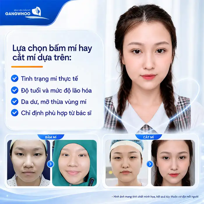 Cắt mí và bấm mí khác nhau như thế nào? Nên bấm mí hay cắt mí