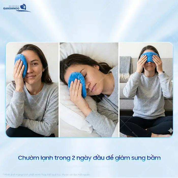 Cắt mí xong bị chảy máu nguyên nhân là gì? Cách xử lý như thế nào?