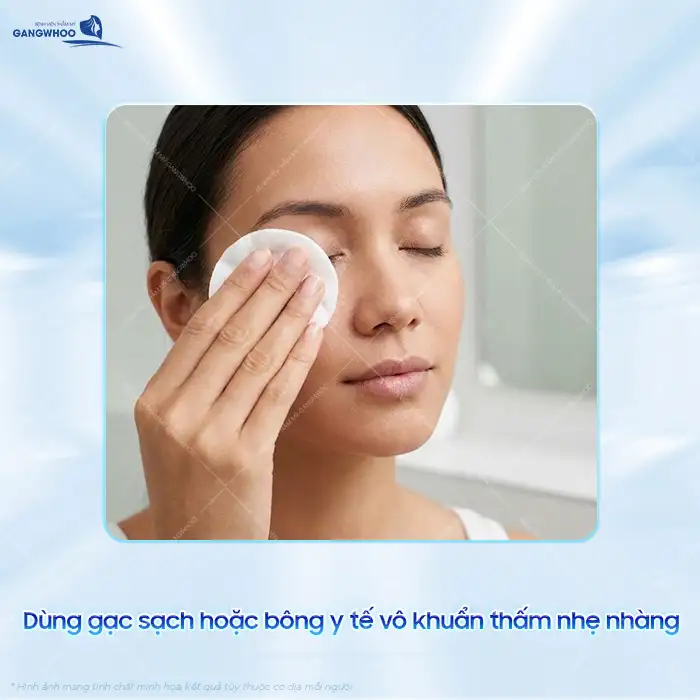 Cắt mí xong bị chảy máu nguyên nhân là gì? Cách xử lý như thế nào?