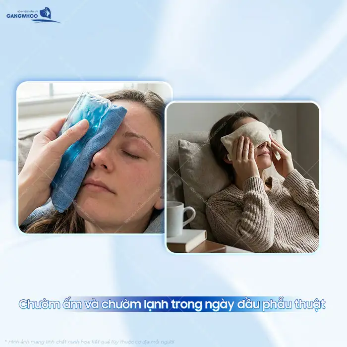 Cắt mí xong bị chảy nước mắt nguyên nhân do đâu? Cách khắc phục ra sao?