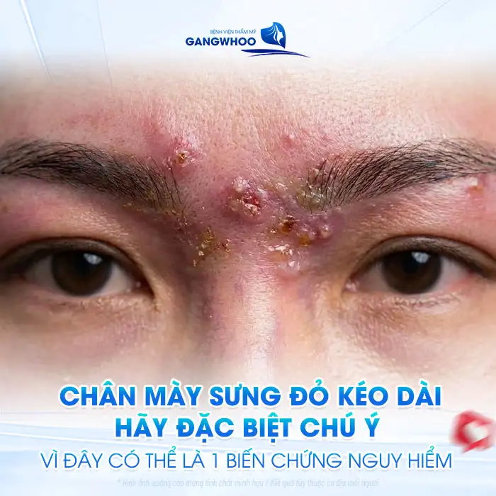 Chăm sóc lông mày sau phun đúng cách giúp bong nhanh, lên màu đẹp