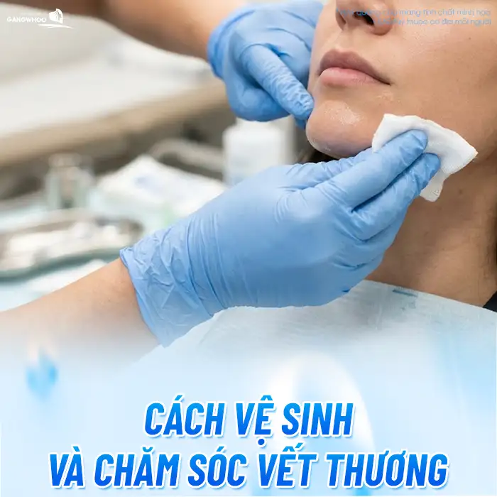 Chăm sóc sau gọt hàm đúng cách giúp mau lành và giảm sưng nhanh