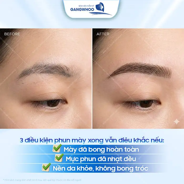 Chân mày phun rồi có điêu khắc được không? Bác sĩ giải đáp chi tiết