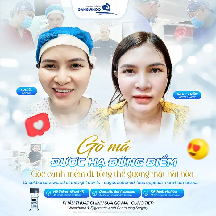 Chườm đá có hạ gò má không? Có hiệu quả như lời đồn không?
