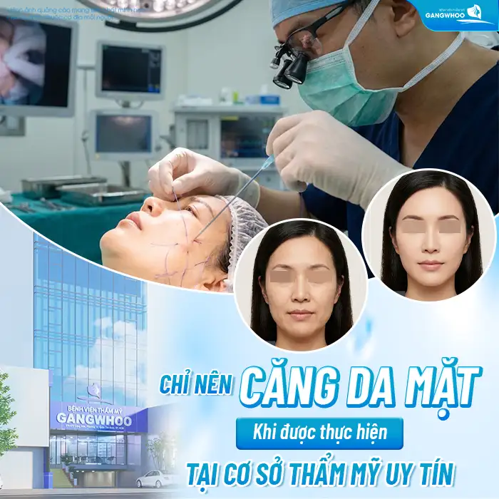 Có nên căng chỉ da mặt không? Những lưu ý trước khi thực hiện
