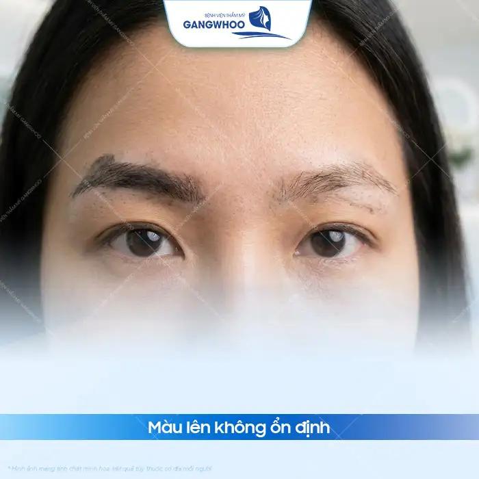 Có nên phun lông mày khi mang thai không? Bác sĩ tư vấn chi tiết