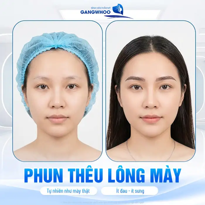 Có nên phun thêu lông mày không? Cần lưu ý gì trước khi thực hiện