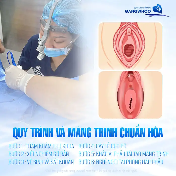 Có nên vá màng trinh không? Những lợi ích khi vá màng trinh