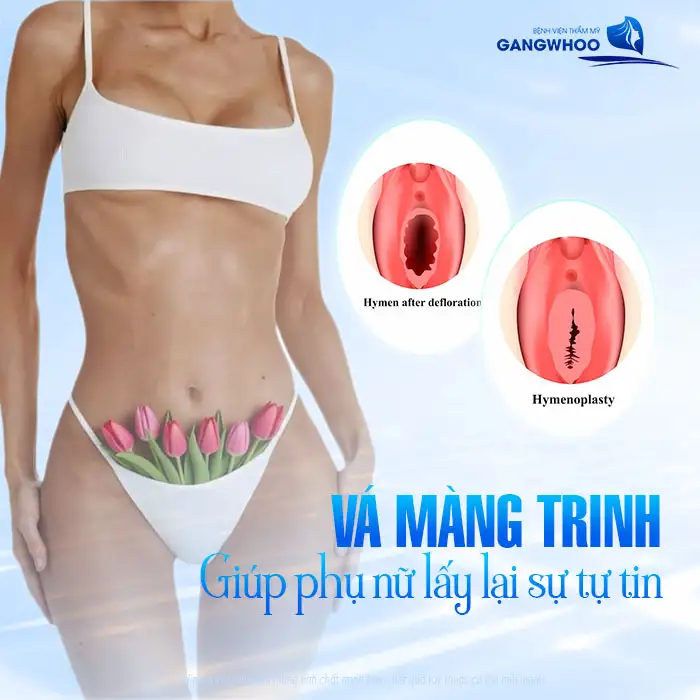 Có nên vá màng trinh không? Những lợi ích khi vá màng trinh