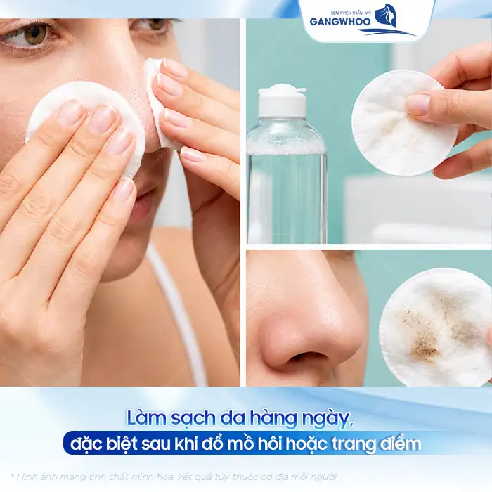 Tham khảo cách điều trị mụn cám ở mũi an toàn, đơn giản