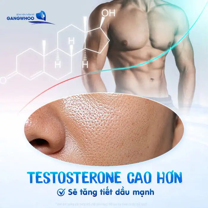 Có nên điều trị mụn cho nam giới? Phương pháp nào hiệu quả