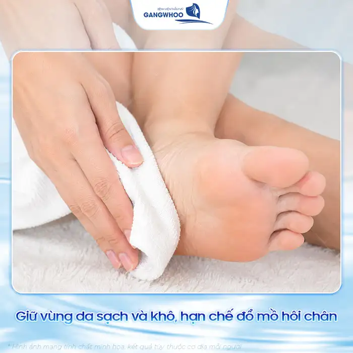 Cách điều trị mụn cóc ở chân đúng cách để tránh lây lan, tái phát