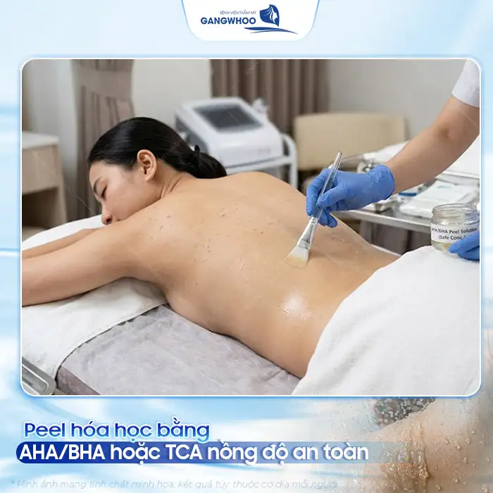 Phác đồ điều trị mụn lưng và viêm nang lông hiệu quả, an toàn