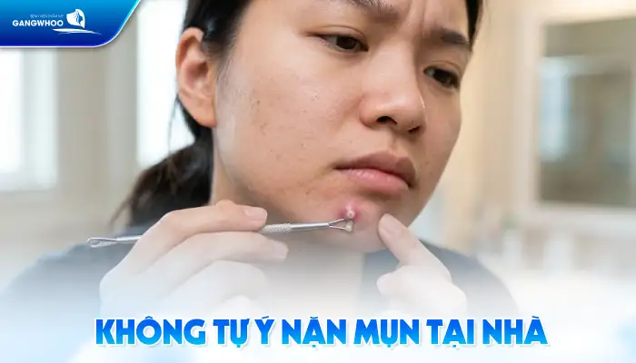 Cách điều trị mụn u nang an toàn, hiệu quả tránh gây sẹo xấu