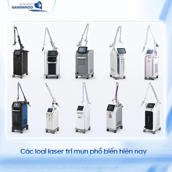 Điều trị thâm mụn bằng laser có hiệu quả không? Quy trình ra sao?