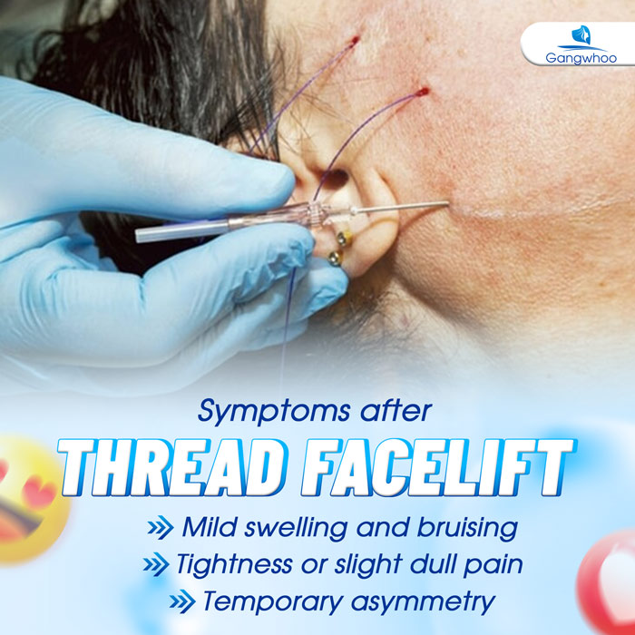 Post-Thread Lift Care: What to Eat, Avoid, and Keep in Mind 1 Post-Thread Lift Care: What to Eat, Avoid, and Keep in Mind